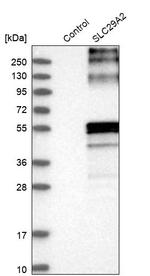 ENT2 Antibody in Western Blot (WB)