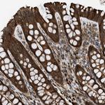 SESN2 Antibody in Immunohistochemistry (Paraffin) (IHC (P))