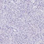 GUCA2A Antibody in Immunohistochemistry (Paraffin) (IHC (P))