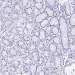 GUCA2A Antibody in Immunohistochemistry (Paraffin) (IHC (P))