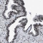 SMARCB1 Antibody in Immunohistochemistry (Paraffin) (IHC (P))