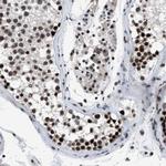 SMARCB1 Antibody in Immunohistochemistry (Paraffin) (IHC (P))