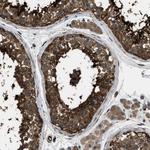 PFKP Antibody in Immunohistochemistry (Paraffin) (IHC (P))