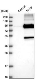 PFKP Antibody in Western Blot (WB)