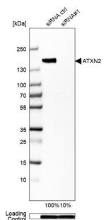 Ataxin 2 Antibody