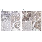 Ataxin 2 Antibody in Immunohistochemistry (IHC)