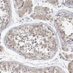 Ataxin 2 Antibody in Immunohistochemistry (IHC)