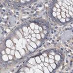 Ataxin 2 Antibody in Immunohistochemistry (IHC)