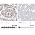 Ataxin 2 Antibody