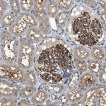 Cbl-b Antibody in Immunohistochemistry (Paraffin) (IHC (P))