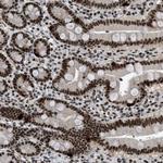 URB1 Antibody in Immunohistochemistry (Paraffin) (IHC (P))