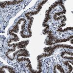 URB1 Antibody in Immunohistochemistry (Paraffin) (IHC (P))