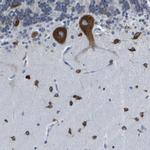 G3BP2 Antibody in Immunohistochemistry (IHC)