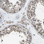 G3BP2 Antibody in Immunohistochemistry (IHC)