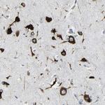 G3BP2 Antibody in Immunohistochemistry (IHC)