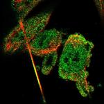 CBR3 Antibody in Immunocytochemistry (ICC/IF)