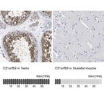 C21orf59 Antibody in Immunohistochemistry (IHC)