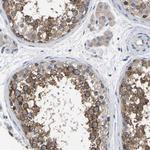 C21orf59 Antibody in Immunohistochemistry (IHC)