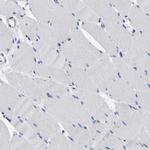 C21orf59 Antibody in Immunohistochemistry (IHC)