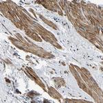 KCTD17 Antibody in Immunohistochemistry (Paraffin) (IHC (P))