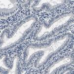 PPM1E Antibody in Immunohistochemistry (Paraffin) (IHC (P))