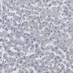 PPM1E Antibody in Immunohistochemistry (Paraffin) (IHC (P))