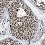 PPM1E Antibody in Immunohistochemistry (Paraffin) (IHC (P))