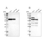 NOP58 Antibody in Western Blot (WB)