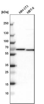 NOP58 Antibody in Western Blot (WB)