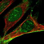 Septin 2 Antibody in Immunocytochemistry (ICC/IF)