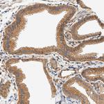 Septin 2 Antibody in Immunohistochemistry (IHC)