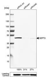 Septin 2 Antibody in Western Blot (WB)