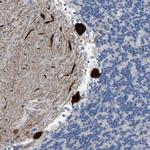 PDE1B Antibody in Immunohistochemistry (Paraffin) (IHC (P))