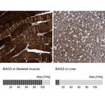 BAG3 Antibody in Immunohistochemistry (IHC)