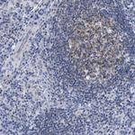 Lrmp Antibody in Immunohistochemistry (Paraffin) (IHC (P))