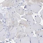 Lrmp Antibody in Immunohistochemistry (Paraffin) (IHC (P))