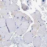 Lrmp Antibody in Immunohistochemistry (IHC)