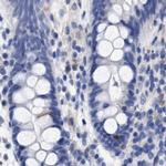 Lrmp Antibody in Immunohistochemistry (IHC)