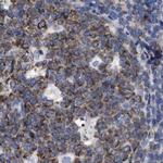 Lrmp Antibody in Immunohistochemistry (IHC)