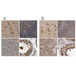 TCP-1 theta Antibody in Immunohistochemistry (IHC)