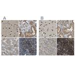 ATP8B1 Antibody in Immunohistochemistry (IHC)