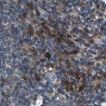 ATP8B1 Antibody in Immunohistochemistry (IHC)