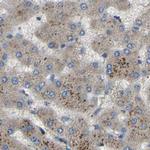 ATP8B1 Antibody in Immunohistochemistry (IHC)