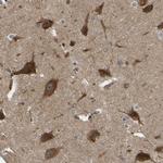 RASGRF2 Antibody in Immunohistochemistry (Paraffin) (IHC (P))