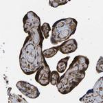 RASGRF2 Antibody in Immunohistochemistry (Paraffin) (IHC (P))