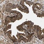 RASGRF2 Antibody in Immunohistochemistry (Paraffin) (IHC (P))