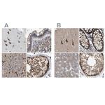 GCN1L1 Antibody in Immunohistochemistry (IHC)