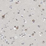 NLE1 Antibody in Immunohistochemistry (Paraffin) (IHC (P))