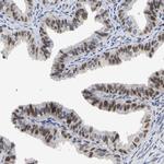 NLE1 Antibody in Immunohistochemistry (Paraffin) (IHC (P))