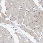 NLE1 Antibody in Immunohistochemistry (Paraffin) (IHC (P))